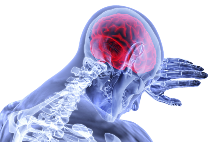 Μεγαλύτερη η πιθανότητα να γλιτώσει κανείς ύστερα από ένα εγκεφαλικό, αν έχει παραπανίσια κιλά